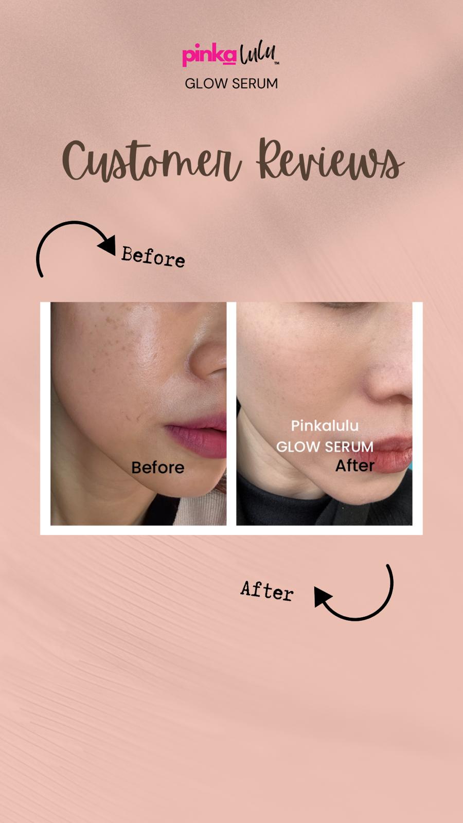 Before and after comparison of a person's face with Pinkalulu Glow Serum on a pink background.