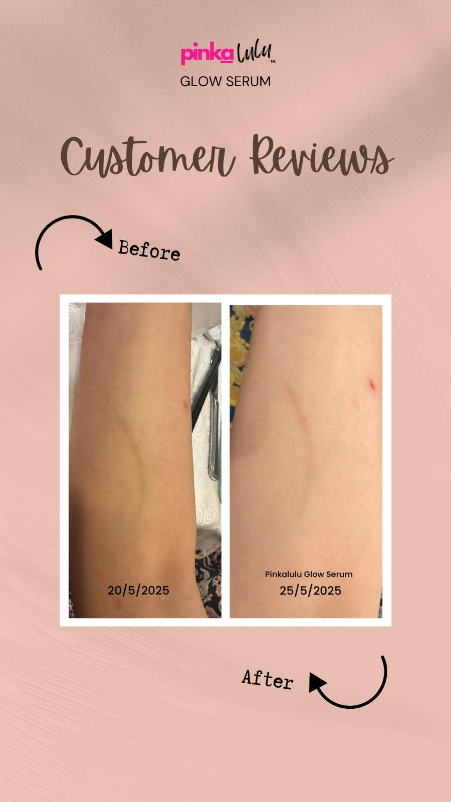 Before and after comparison of skin with pink label and 'Glow Serum' text on a pink background