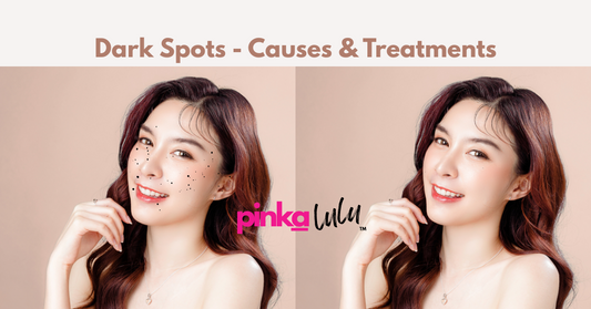 pinkalulu-dark-spots-causes-and-how-to-treat-it-naturally