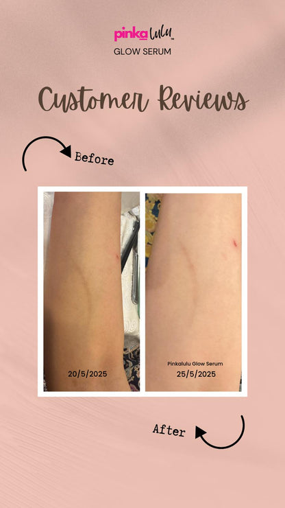 Before and after comparison of skin with pink label and 'Glow Serum' text on a pink background