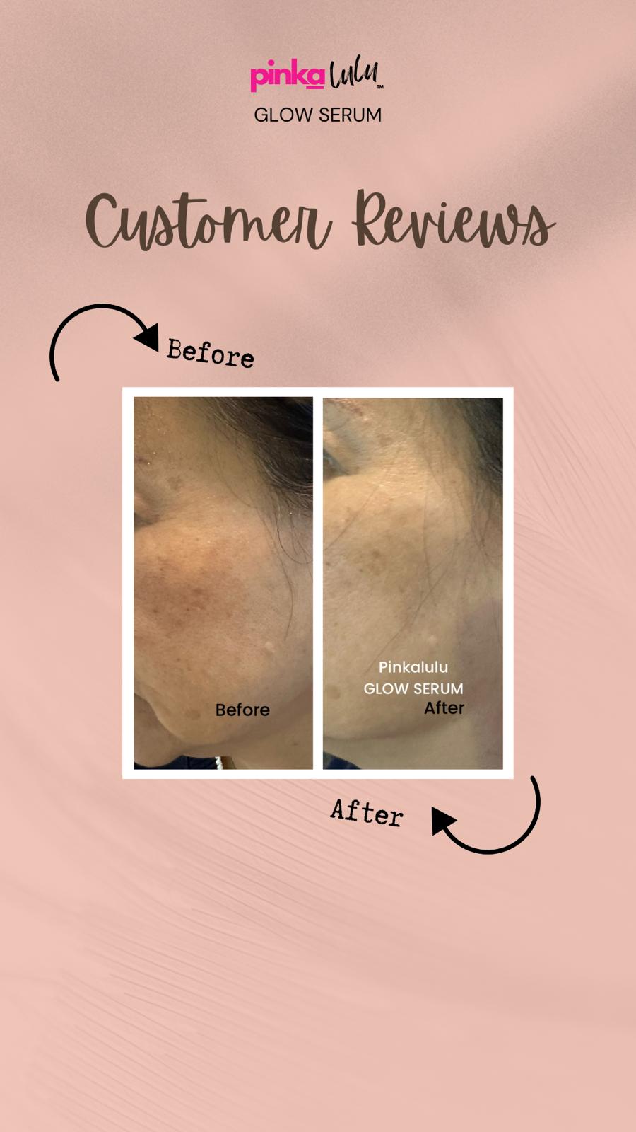 Before and after skin comparison with Pinkla Glow Serum on a pink background